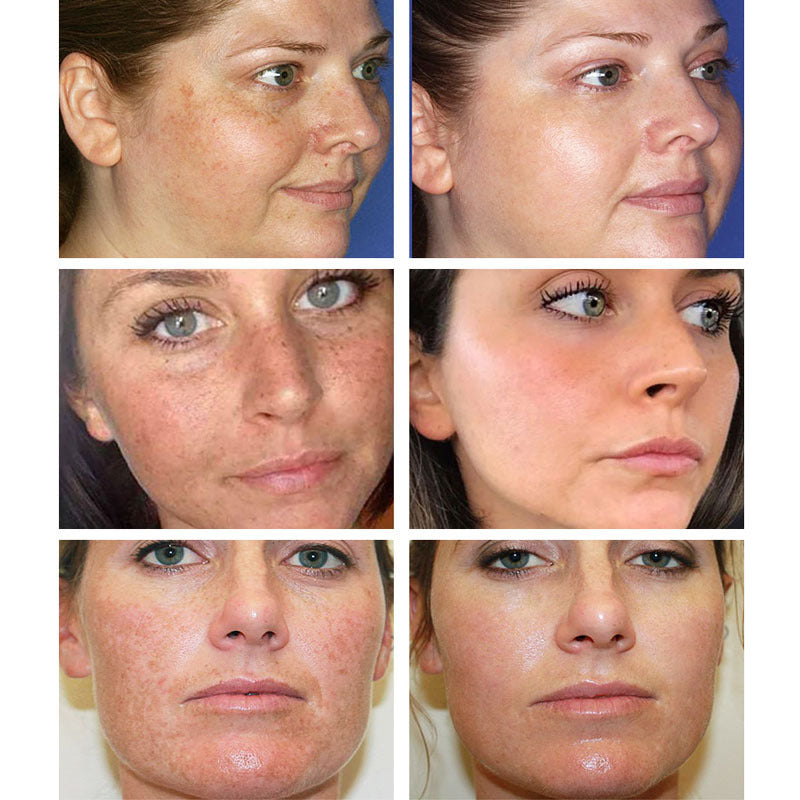 Moisturizing Cream Pore Shrinking Face Cream Hydrating Skin Care Treatment
