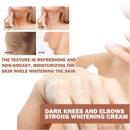 EELHOE Joint Darkening & Brightening Cream Moisturizing Elbow & Knee Repair Cream