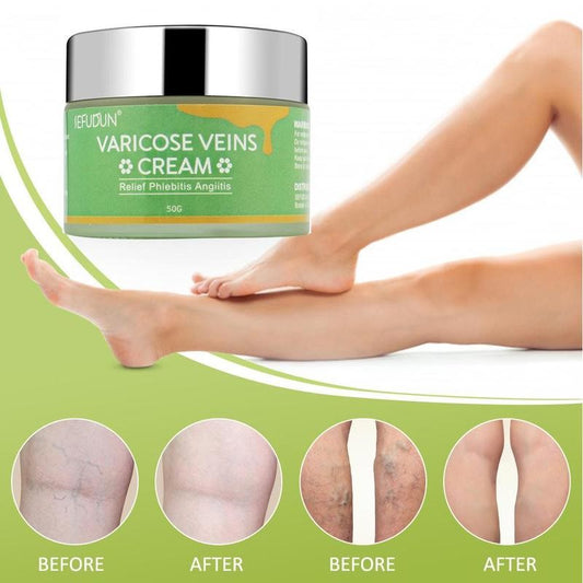 Vein Care Cream Red Blood Streaks Relief Safflower Skin Repair Varicose & Bruise Cream